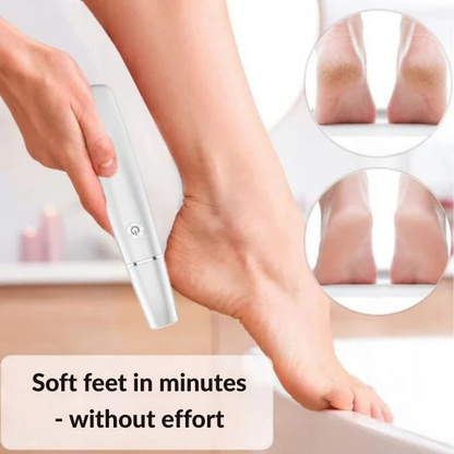 VelvetStride™ — Unleash Silky-Soft Feet That Turn Heads and Boost Your Confidence Instantly