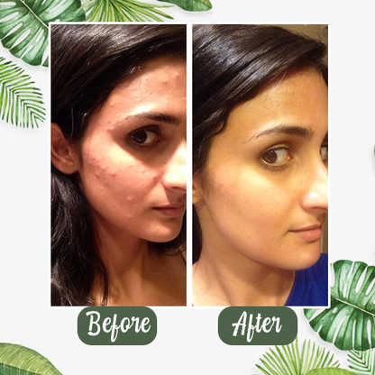 PureRadiance™ Detox Mask Stick — Clear Pores, Boost Glow, and Feel Confident Every Day