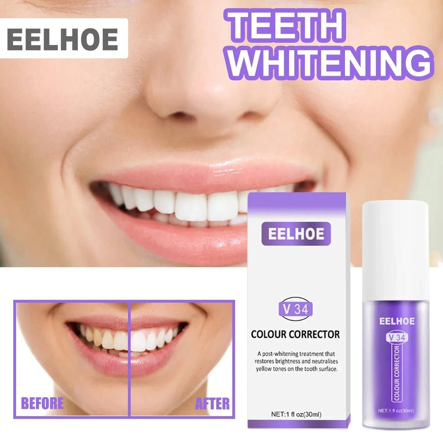 RadianceWhirl™ — Instantly Brighten Your Smile Without Pain or Wait