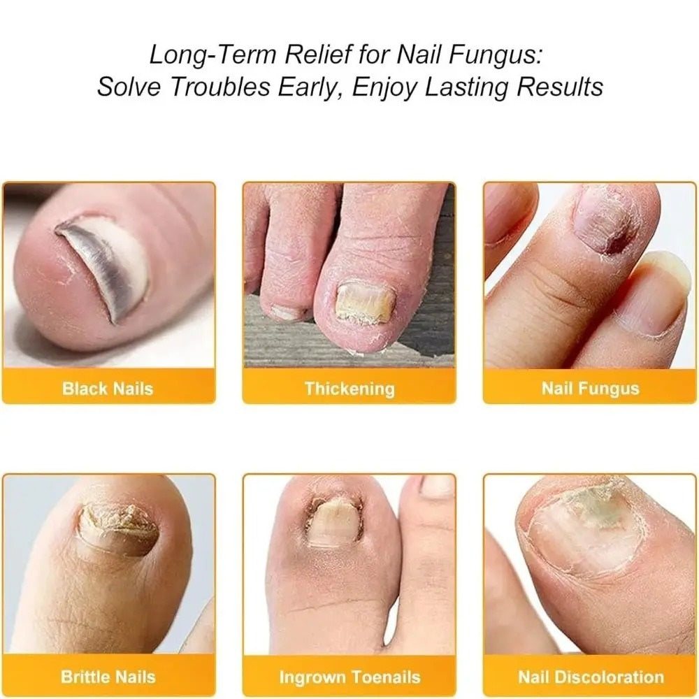 OnyraShield™ — Finally Reveal Clear, Strong Nails That Boost Your Confidence Every Day