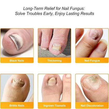 OnyraShield™ — Finally Reveal Clear, Strong Nails That Boost Your Confidence Every Day