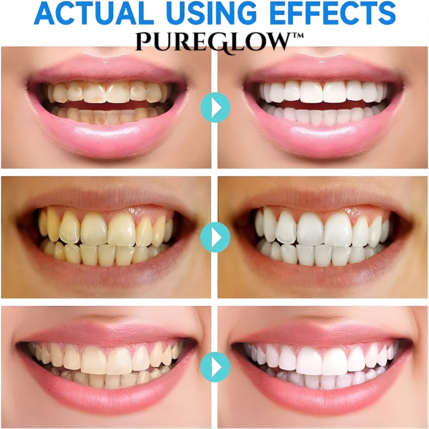 LumaBeam™ — Unlock a Stunning Smile That Radiates Confidence Every Day