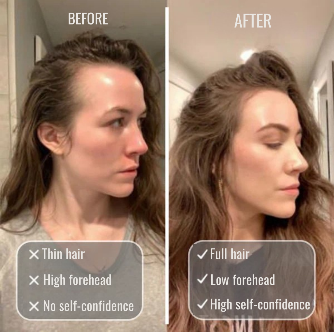 Vivaré Essence™ — Unlock Fuller, Thicker Hair That Commands Attention Every Day