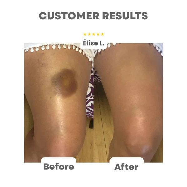 VelaMist™ — Transform Your Skin Instantly with Radiant, Effortless Glow