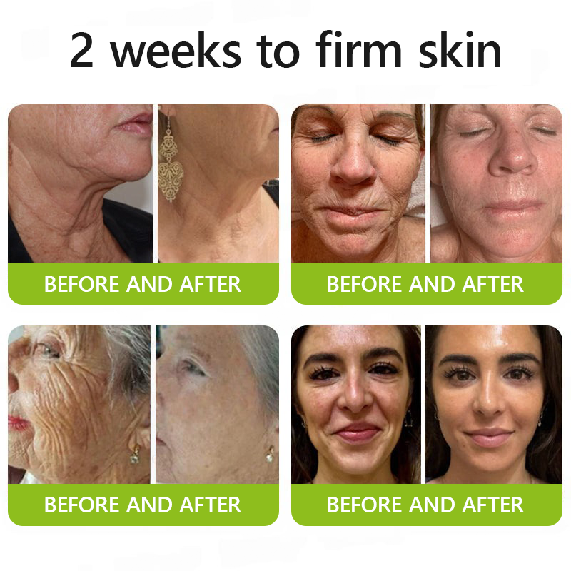 DermaVance™ — Unleash Youthful Lift and Radiance Without Needles or Pain
