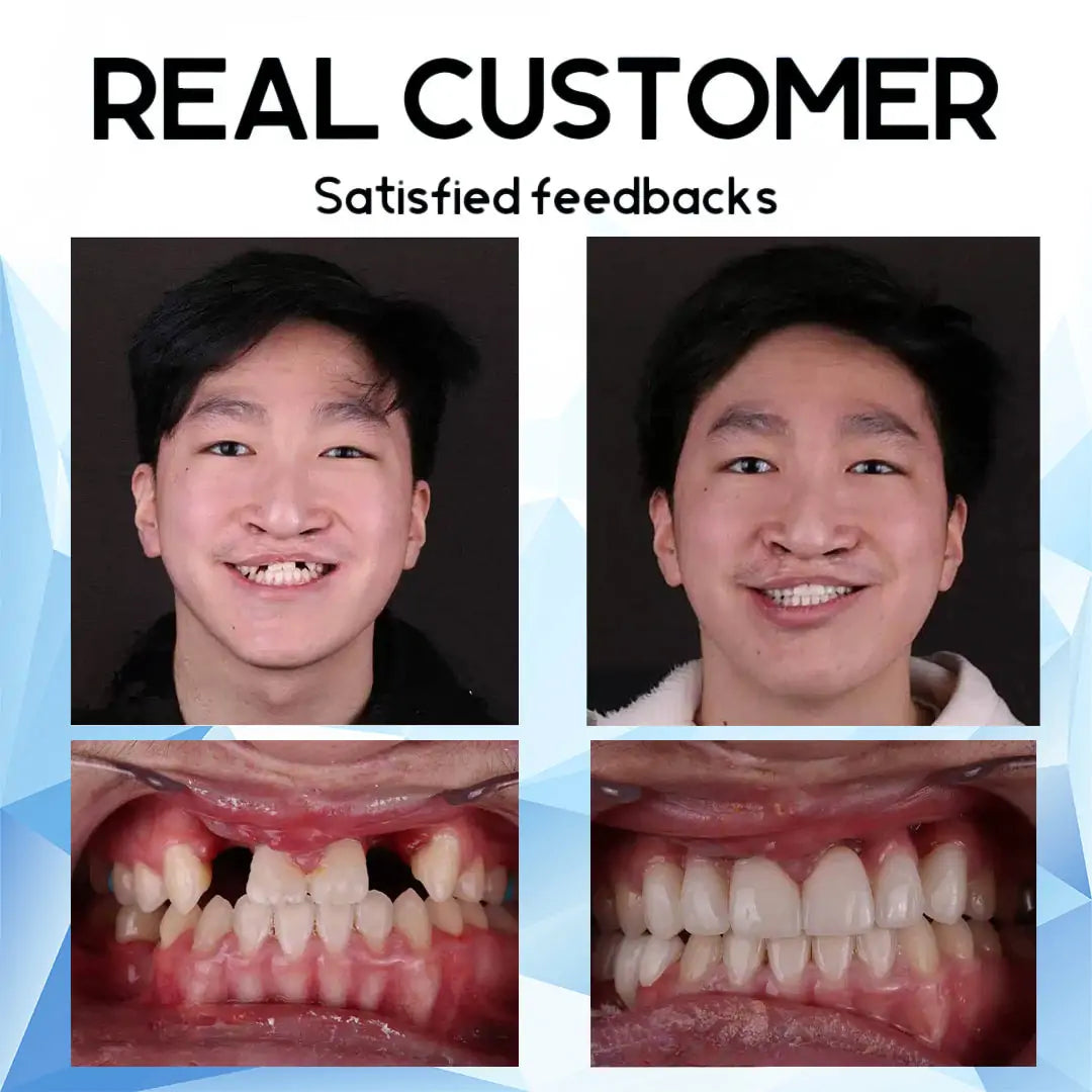 VivaVow™ — Unlock All-Day Comfort and Rock-Solid Confidence for Your Smile