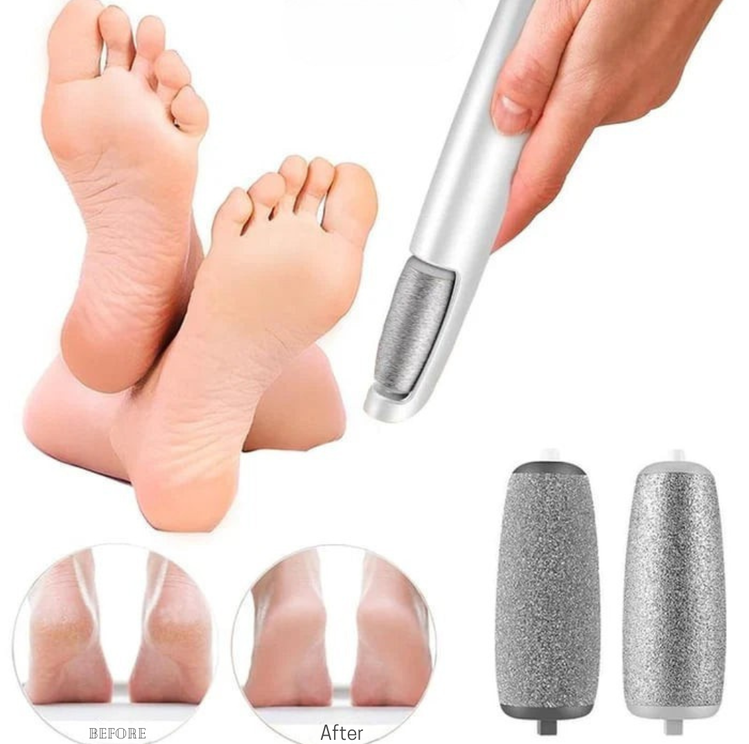 FeatherTouch™ Pro Pedicure Wand — Effortless Precision for Soft, Show-Stopping Feet Every Day