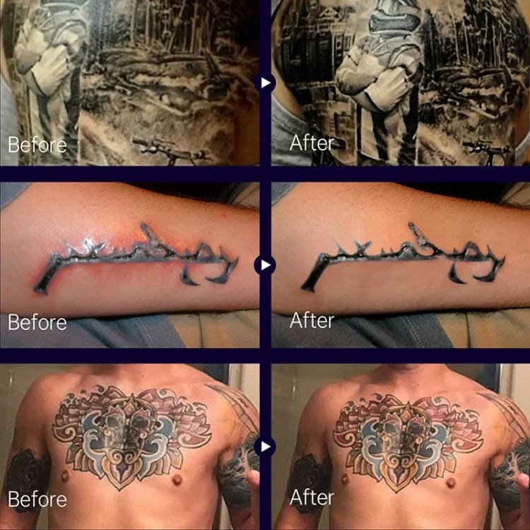 VividShield™ — Keep Your Tattoos Blazing Bright and Pain-Free for Life