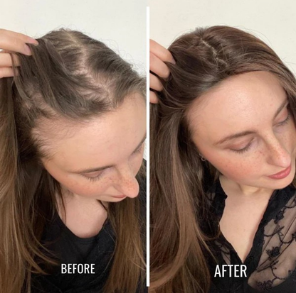 Vivaré Essence™ — Unlock Fuller, Thicker Hair That Commands Attention Every Day