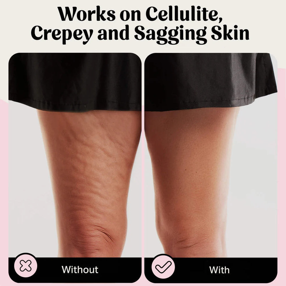 VioraLift™ Body Tape — Instantly Sculpt Your Silhouette and Own Every Moment with Invisible Confidence