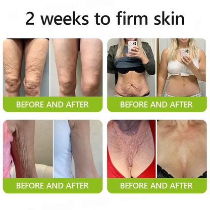 DermaVance™ — Unleash Youthful Lift and Radiance Without Needles or Pain