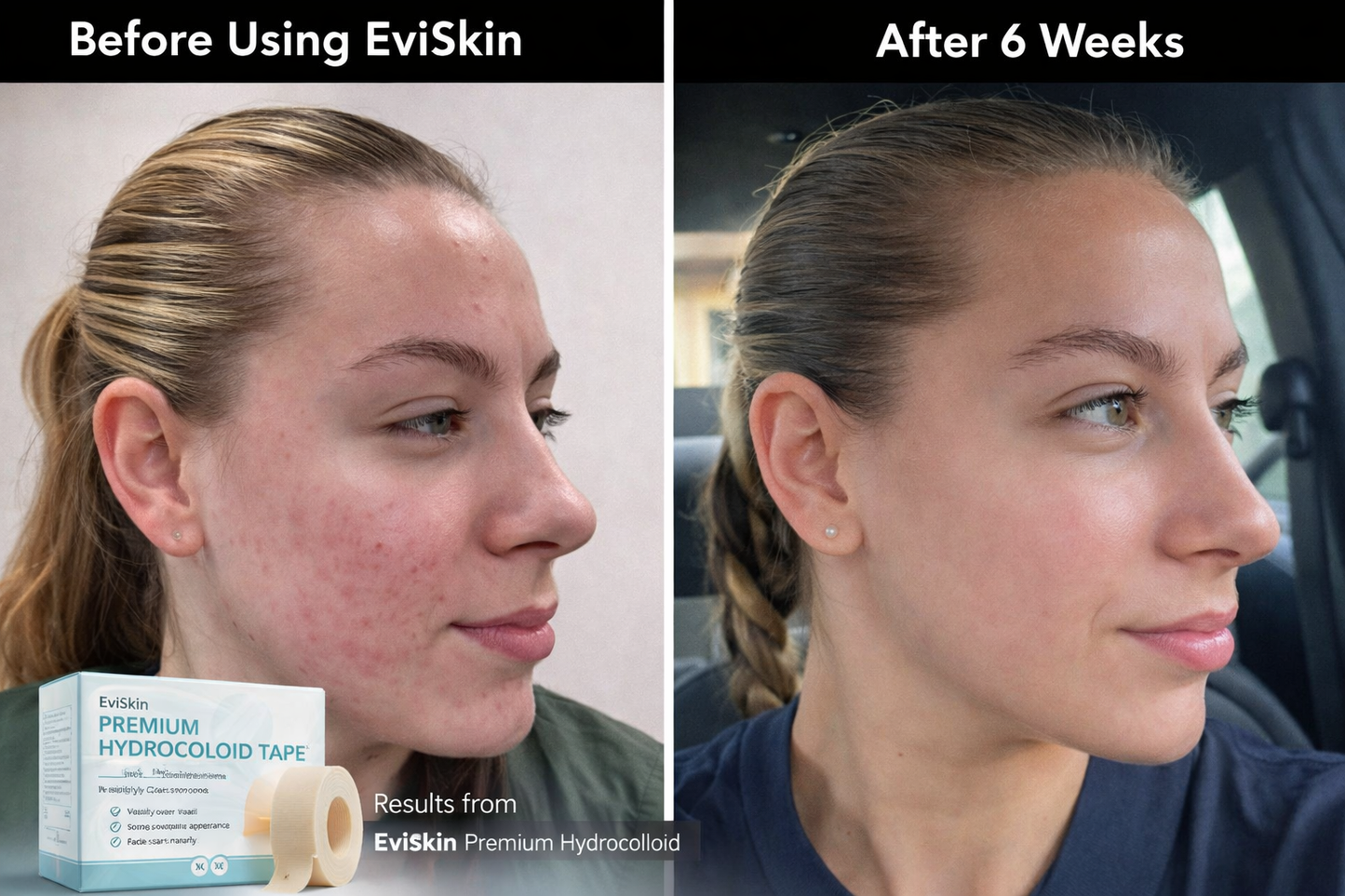ClearLuxe™ — Heal Breakouts Fast and Reveal Your Radiant, Confident Glow