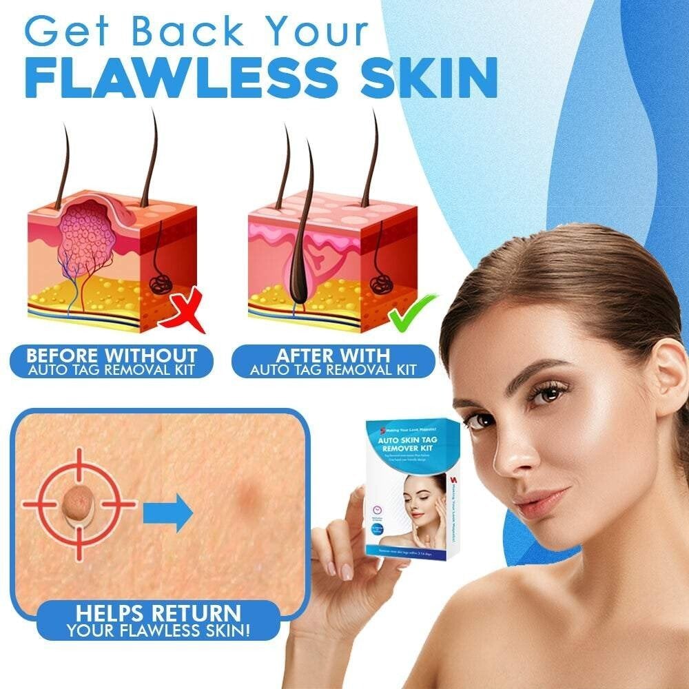 Silquease™ — Effortless Tag Removal That Restores Your Radiant Confidence Fast