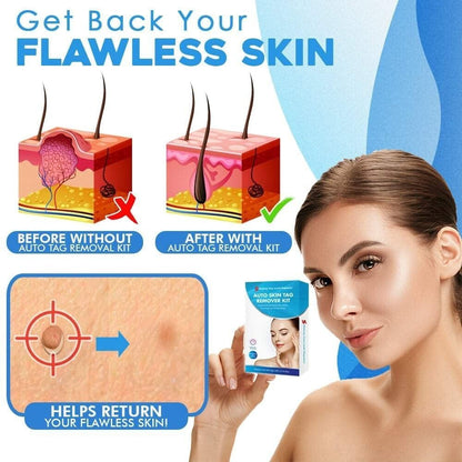 Silquease™ — Effortless Tag Removal That Restores Your Radiant Confidence Fast