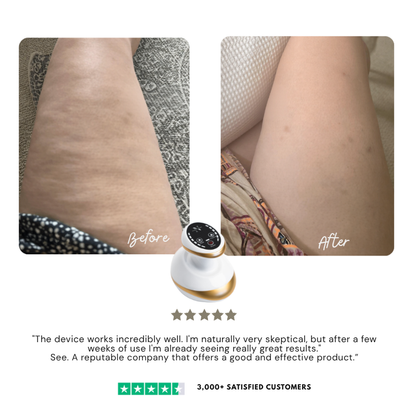 LumaVive™ — Ignite Radiant, Head-Turning Skin That Feels Weightless and Youthful