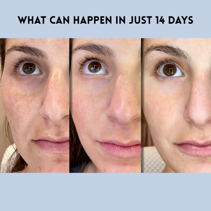 HydraLift™ — Instantly Smash Wrinkles and Glow with Youthful Radiance