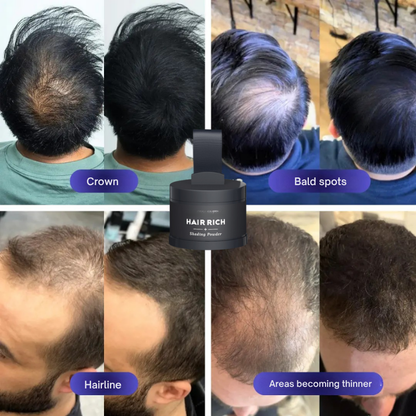 VitalDensity™ — Instantly Transform Your Hairline Into a Confidence Powerhouse