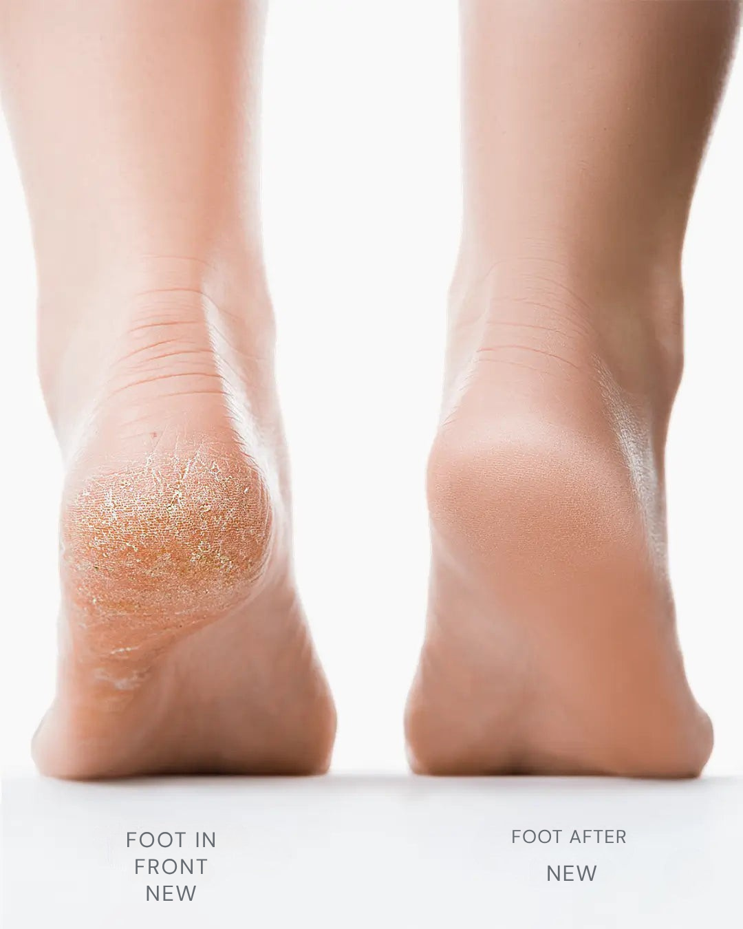 SereniSmooth™ — Instantly Reveal Soft, Silky Feet That Command Attention