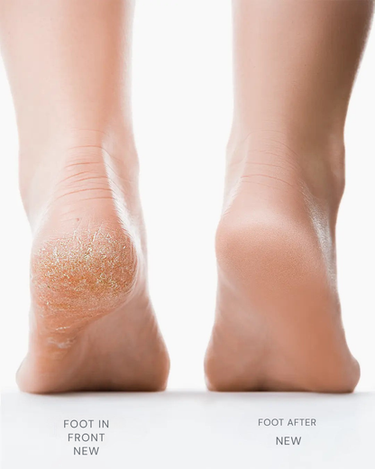 SereniSmooth™ — Instantly Reveal Soft, Silky Feet That Command Attention