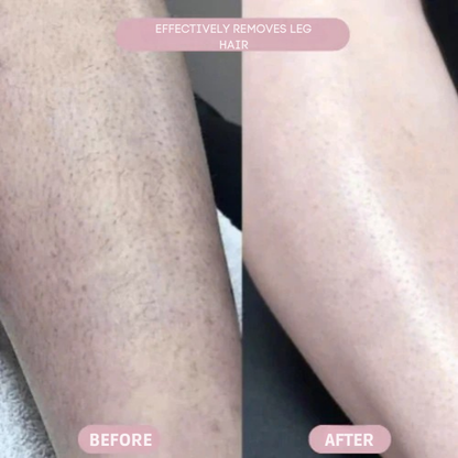 SilkenSculpt™ — Enjoy Silky, Bump-Free Skin Without a Single Cut or Irritation
