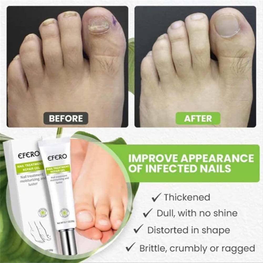 PowerLuxe™ Nail Revival Gel — Unleash Radiant, Unbreakable Nails That Command Attention