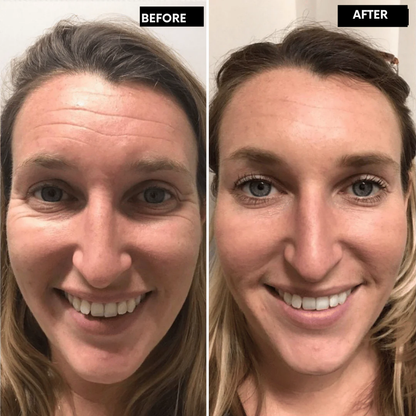 LumaLift™ — Unlock Radiant, Youthful Skin You’ll Crave to Show Off