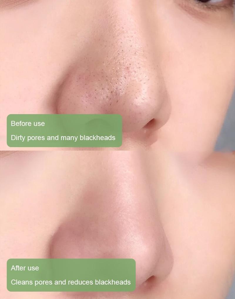 PureRadiance™ Detox Mask Stick — Clear Pores, Boost Glow, and Feel Confident Every Day
