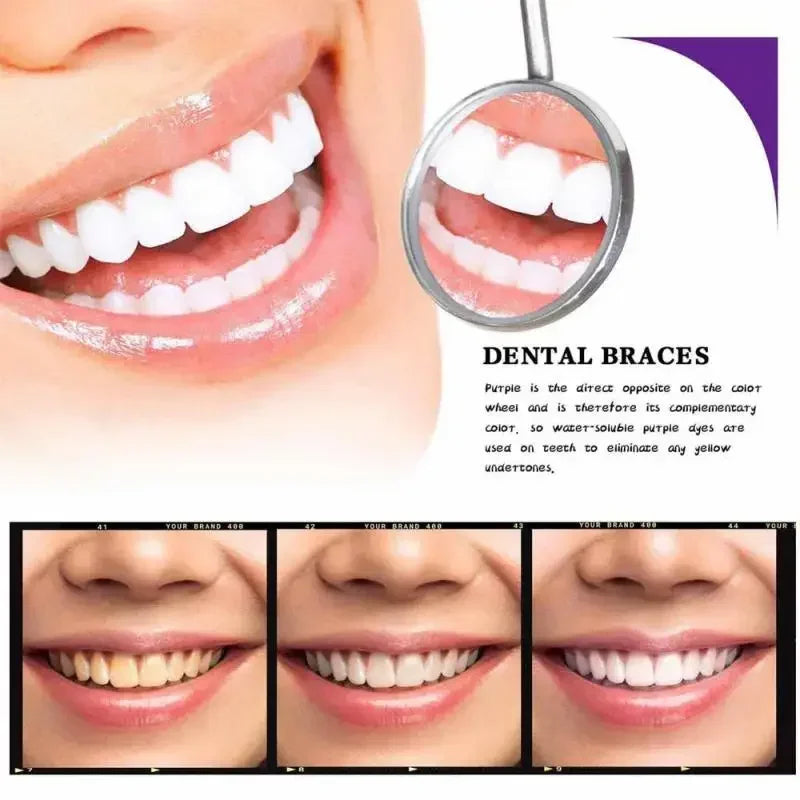 RadianceWhirl™ — Instantly Brighten Your Smile Without Pain or Wait