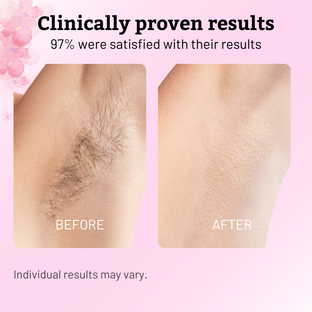 GlowEase™ — Reveal Irresistibly Silky Skin and Say Goodbye to Painful Hair Removal