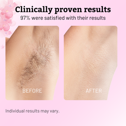 GlowEase™ — Reveal Irresistibly Silky Skin and Say Goodbye to Painful Hair Removal