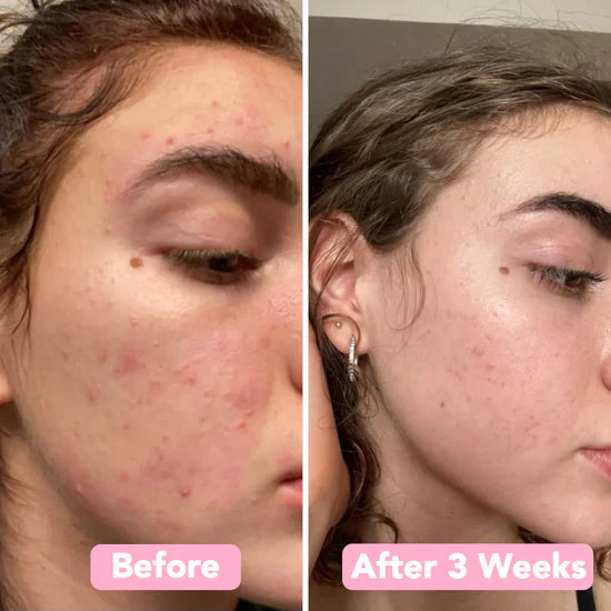 RadianceRush™ Renewal Pads — Wake Up Glowing with Smooth, Spot-Free Skin Every Day