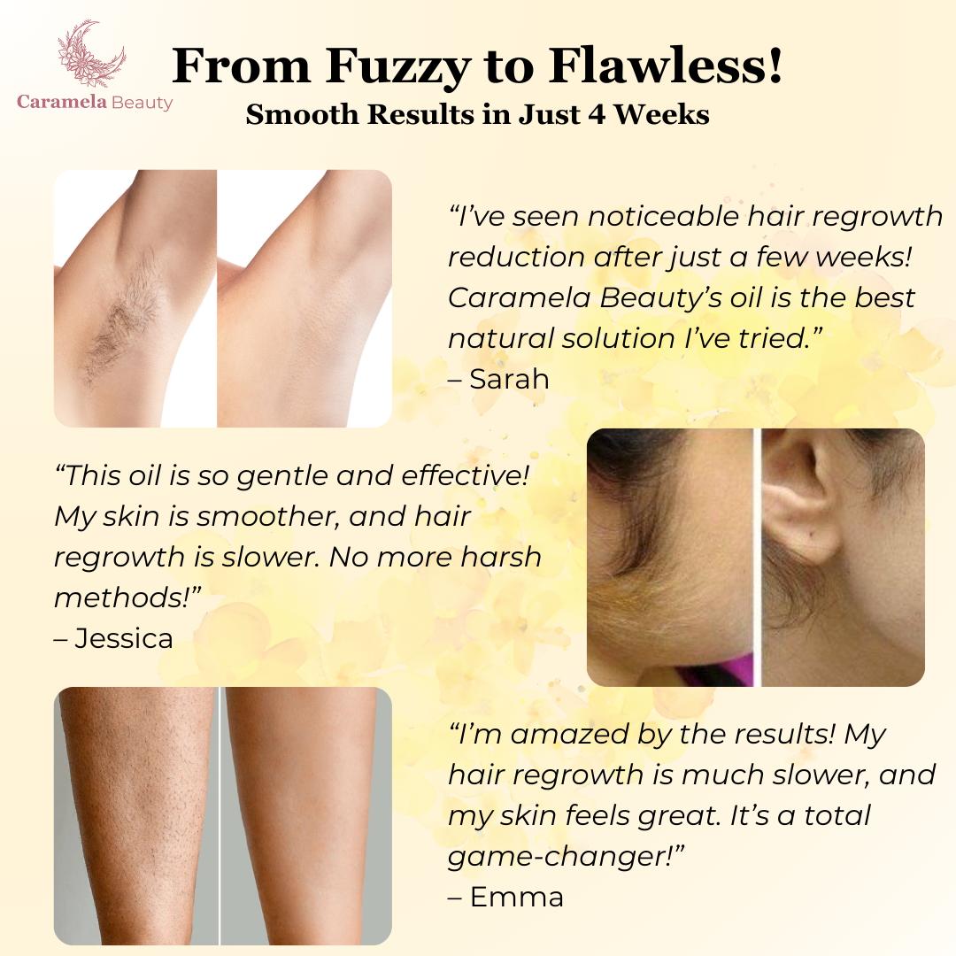 GlowEase™ — Reveal Irresistibly Silky Skin and Say Goodbye to Painful Hair Removal