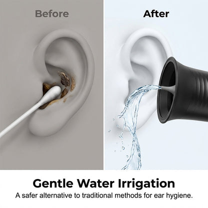 ZenSonic™ — Effortless Ear Care That Leaves You Feeling Fresh, Clear, and Confident