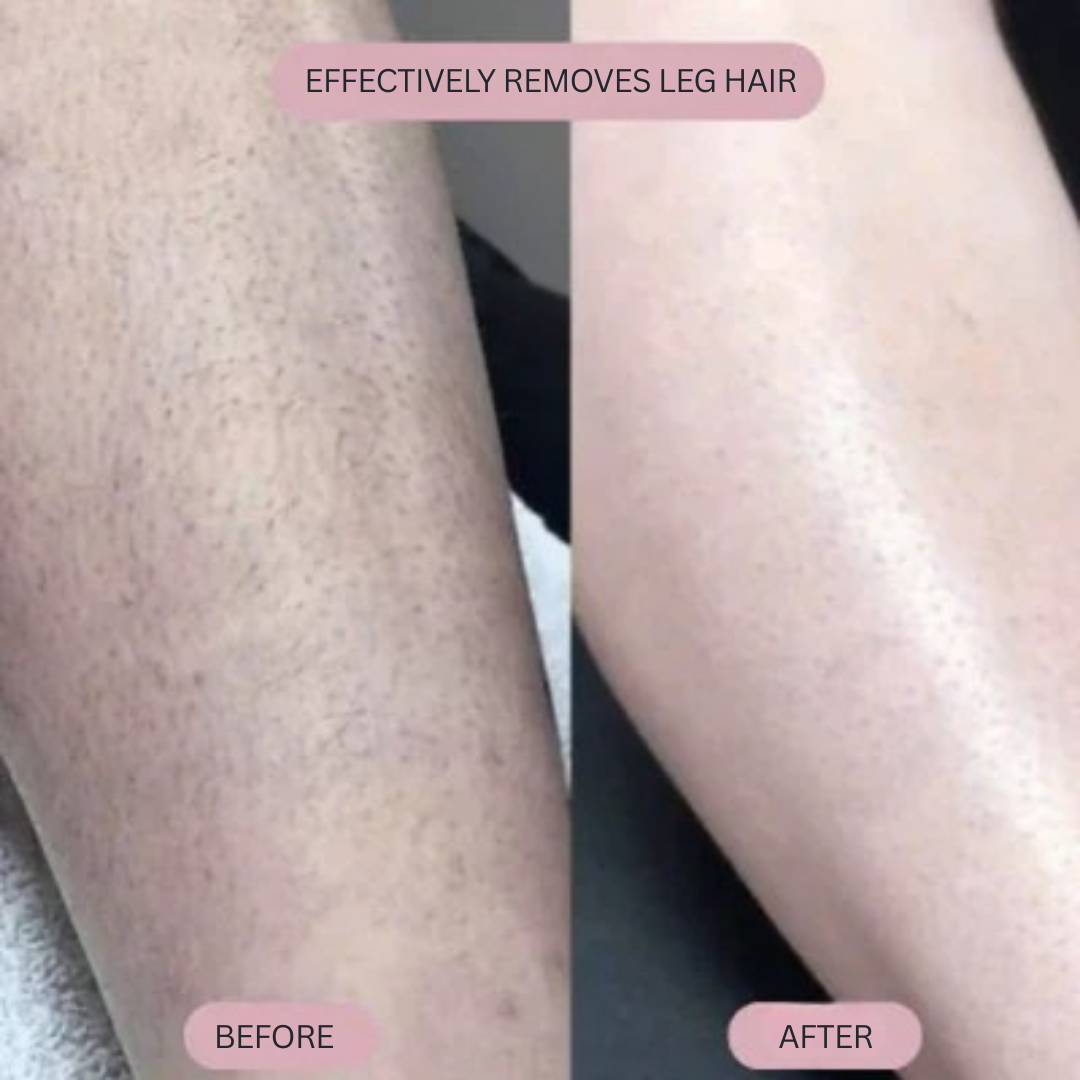 Velora™ — Experience Silky-Smooth, Irritation-Free Skin That Boosts Your Confidence Every Day