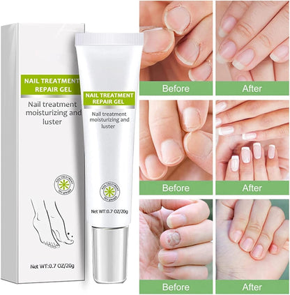 PowerLuxe™ Nail Revival Gel — Unleash Radiant, Unbreakable Nails That Command Attention