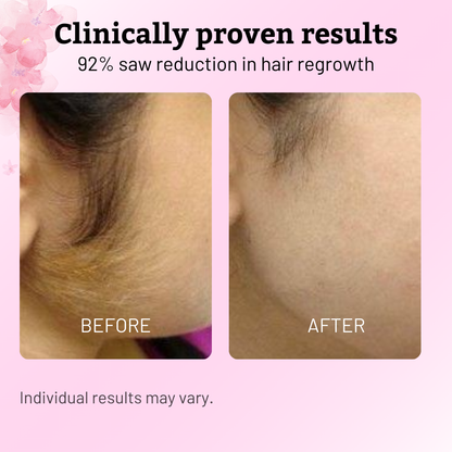 GlowEase™ — Reveal Irresistibly Silky Skin and Say Goodbye to Painful Hair Removal