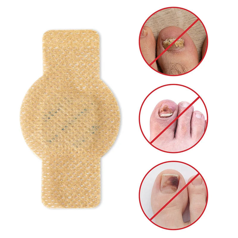 FungiShield™ Patches — Silent, Powerful Defense for Nails You’re Proud to Show Off