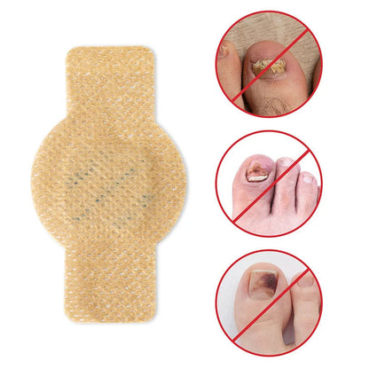 FungiShield™ Patches — Silent, Powerful Defense for Nails You’re Proud to Show Off