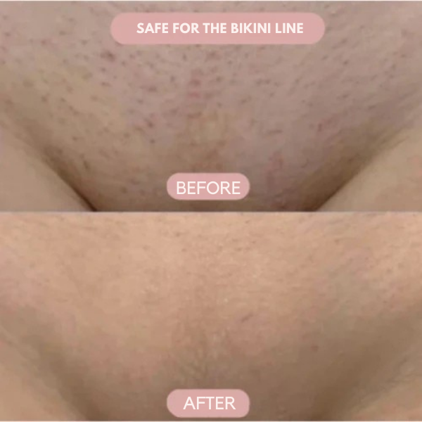 SilkenSculpt™ — Enjoy Silky, Bump-Free Skin Without a Single Cut or Irritation