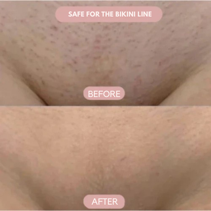 SilkenSculpt™ — Enjoy Silky, Bump-Free Skin Without a Single Cut or Irritation