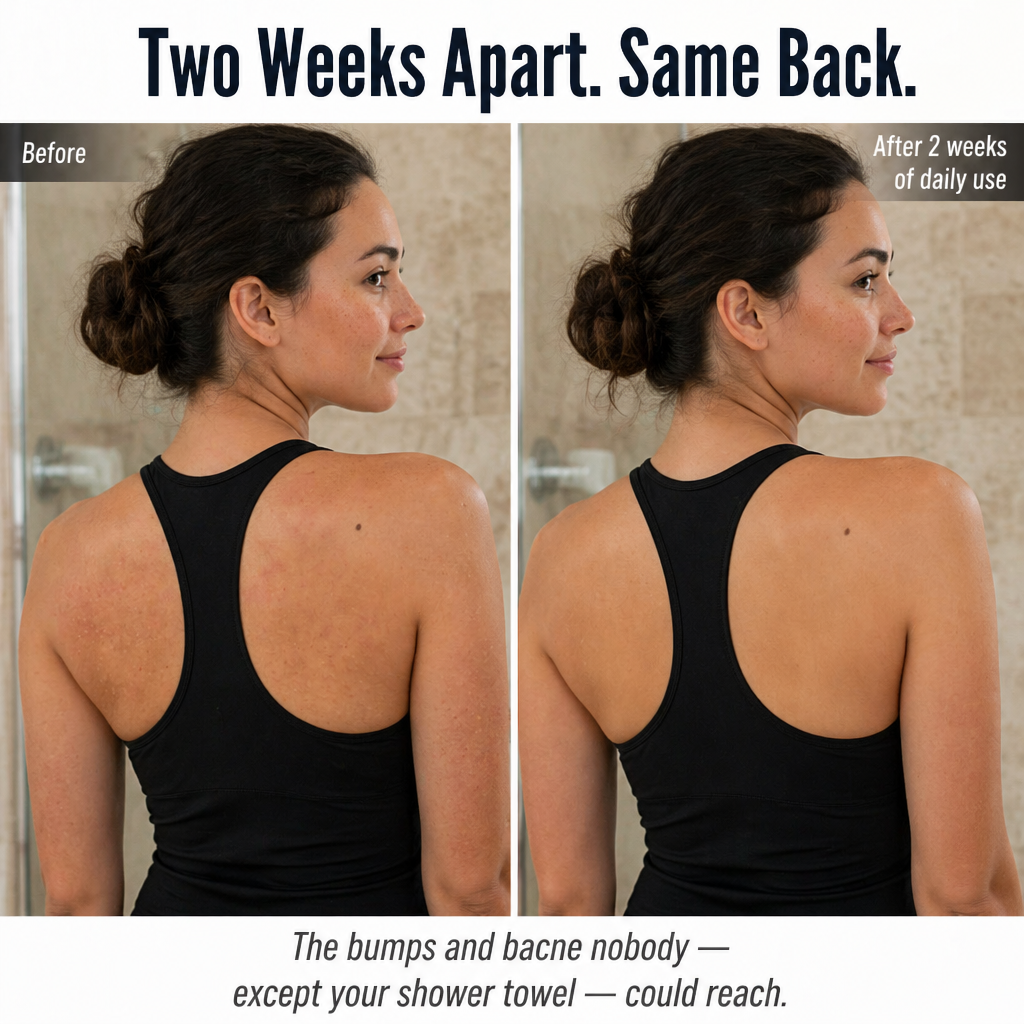 LuminaSheer™ — Sweep Away Bacne, Back Bumps & Dead Skin a Loofah Can't Reach