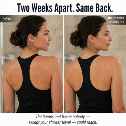 LuminaSheer™ — Sweep Away Bacne, Back Bumps & Dead Skin a Loofah Can't Reach